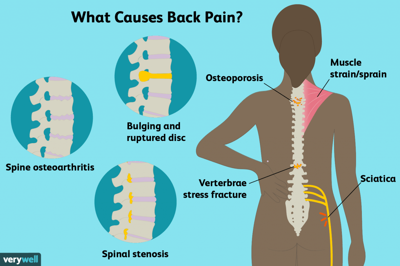 Neck stiff headaches headache spine occipital